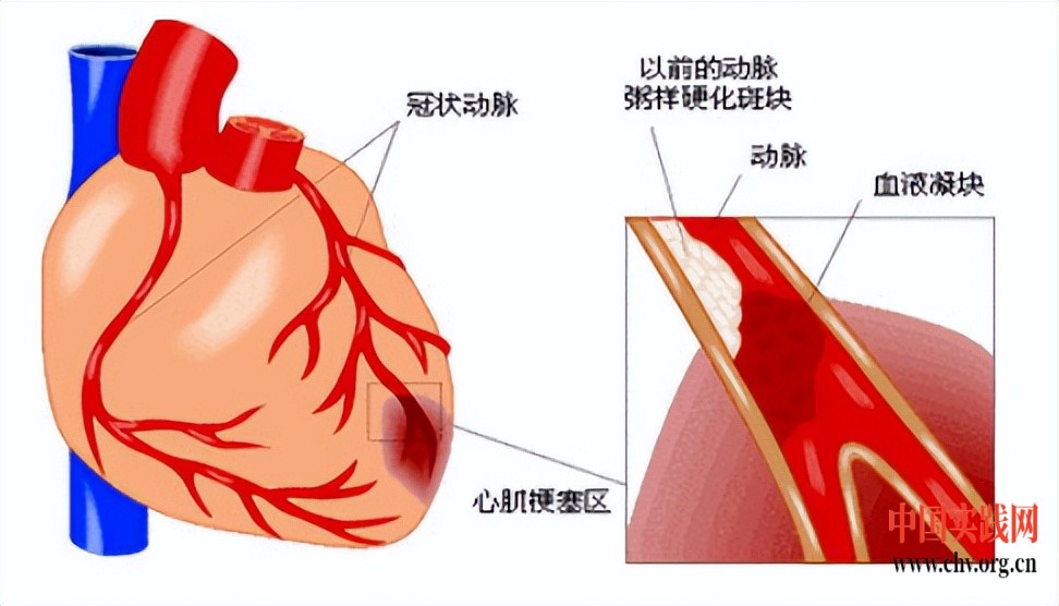 111f2f9adb72430abe4005d2c66aa2d7~tplv-obj.jpg